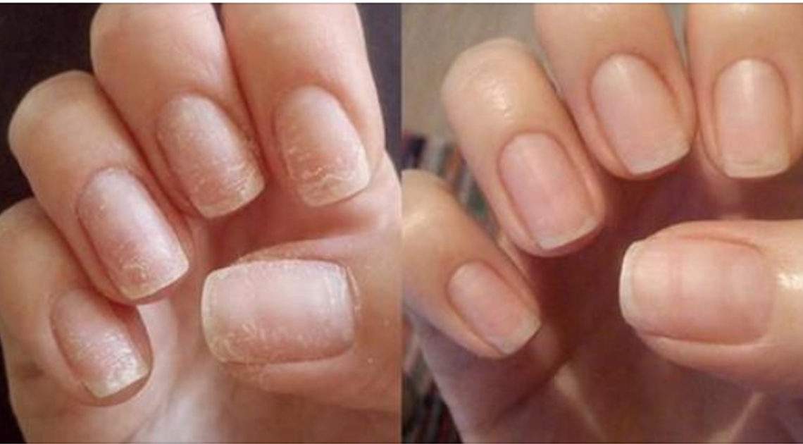 Супер способ восстановить ногти после наращивания или гель-лака