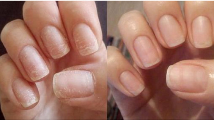 Супер способ восстановить ногти после наращивания или гель-лака